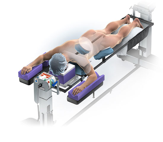 Spinal / Prone Positioning