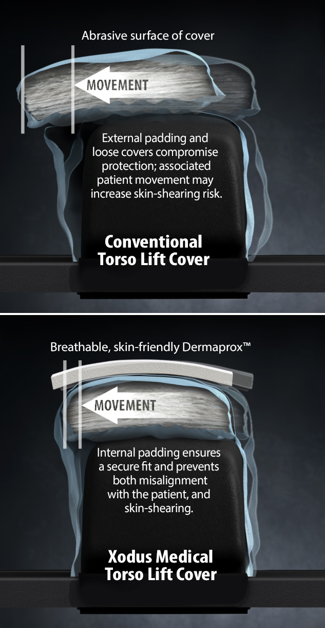 Torso Lift Comparison