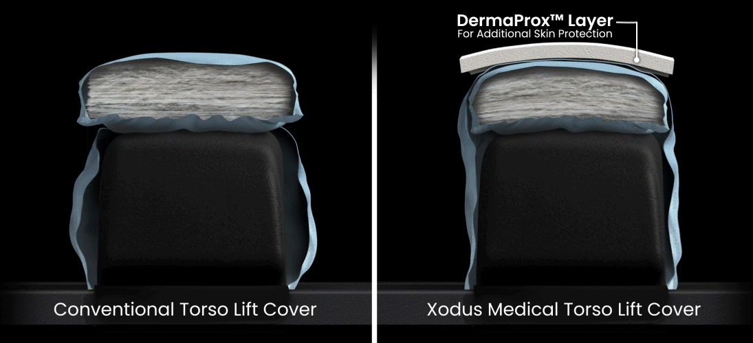 Torso Lift Comparison