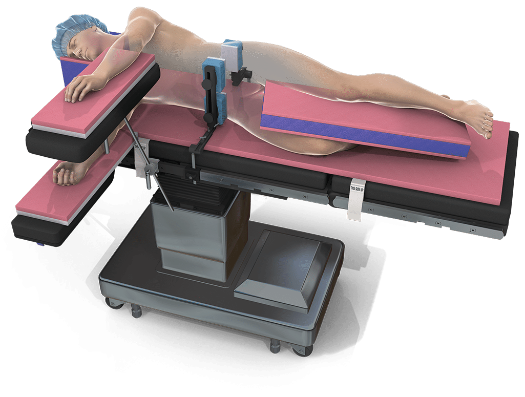 The Pink Hip Kit - Postless Hip Positioning System by Xodus Medical