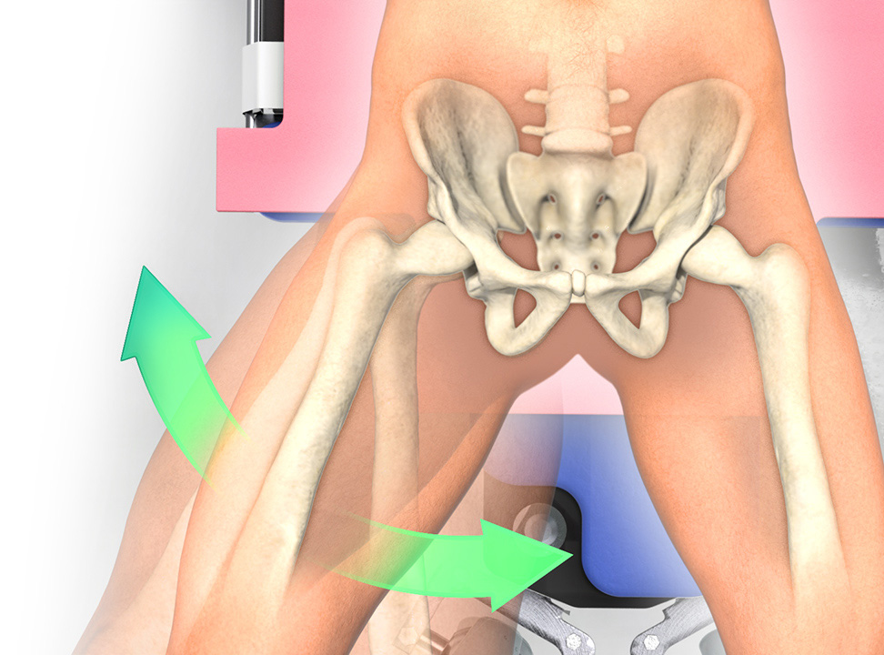 hip rotation example